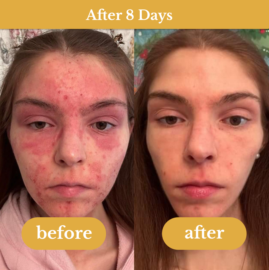 Nurture Your Family’s Skin with Confidence